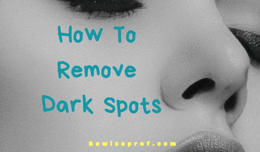 How To Remove Dark Spots