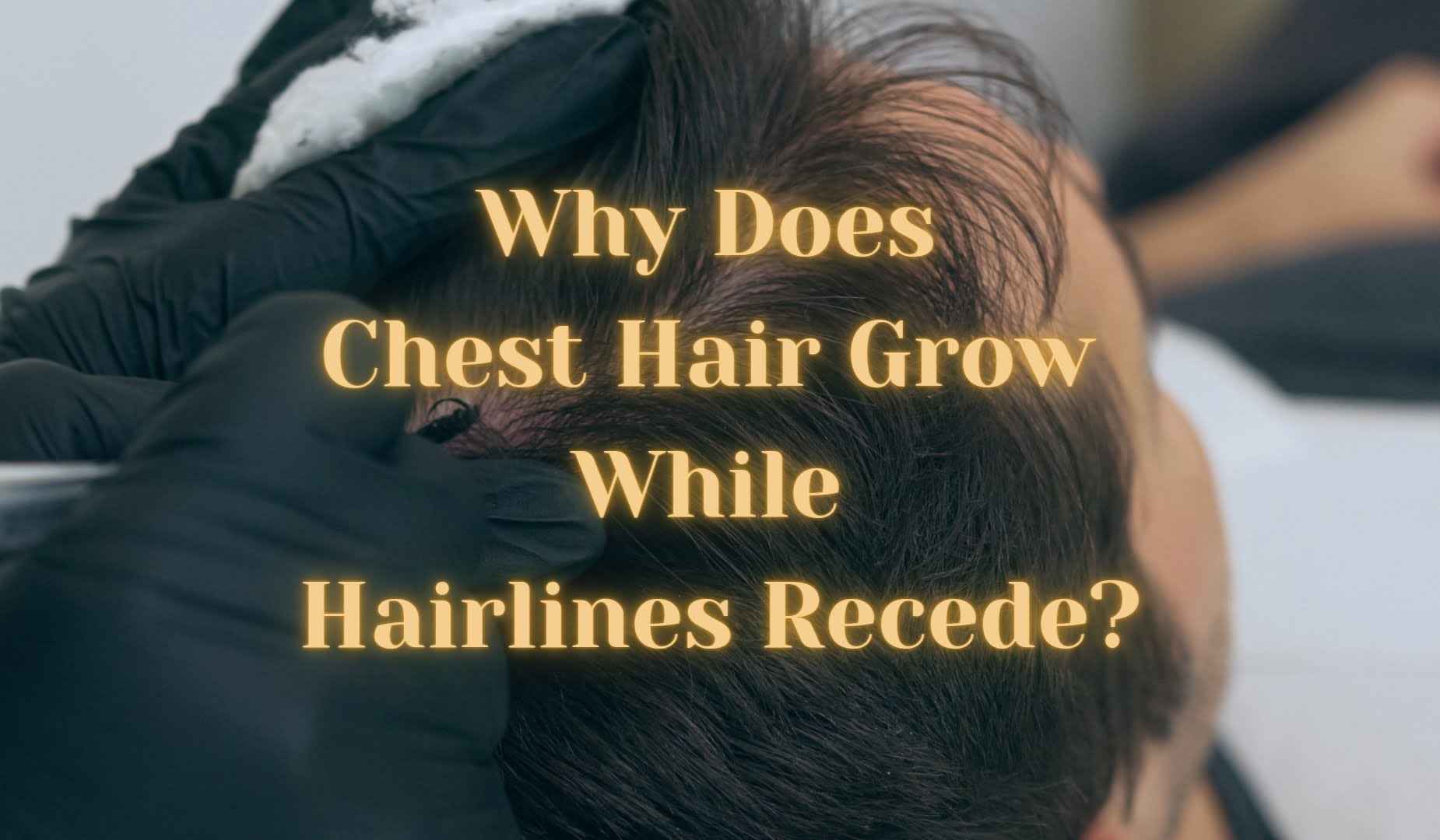 Why Does Chest Hair Grow While Hairlines Recede?