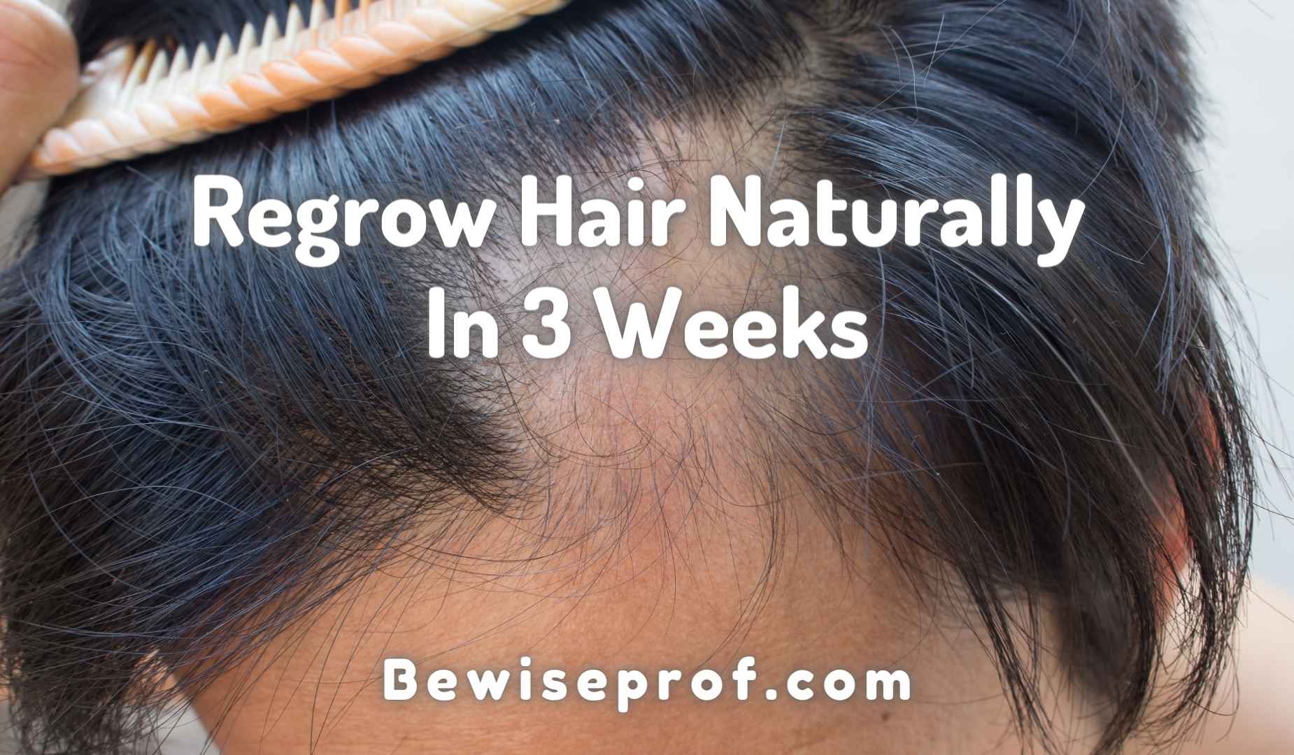 Regrow Hair Naturally In 3 Weeks