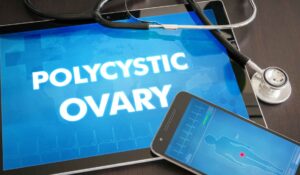 How To Cure Polycystic Ovary Syndrome PCOS