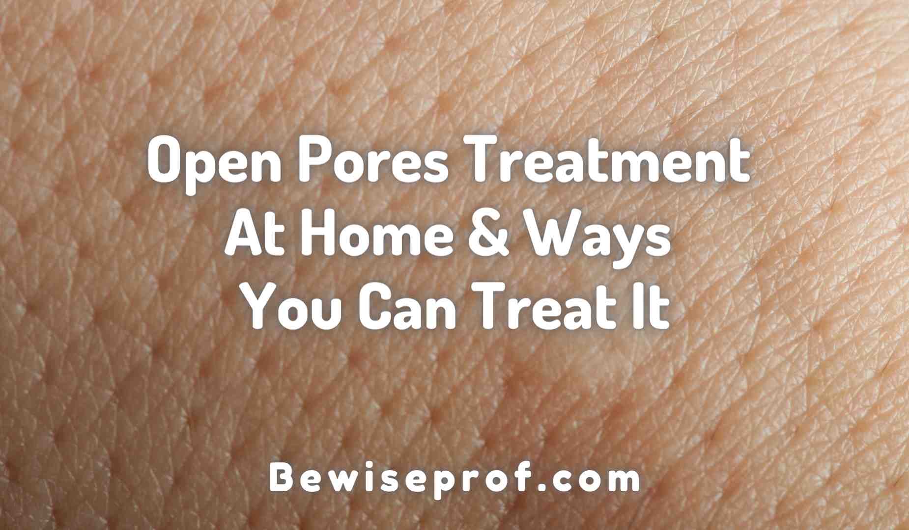Open Pores Treatment At Home
