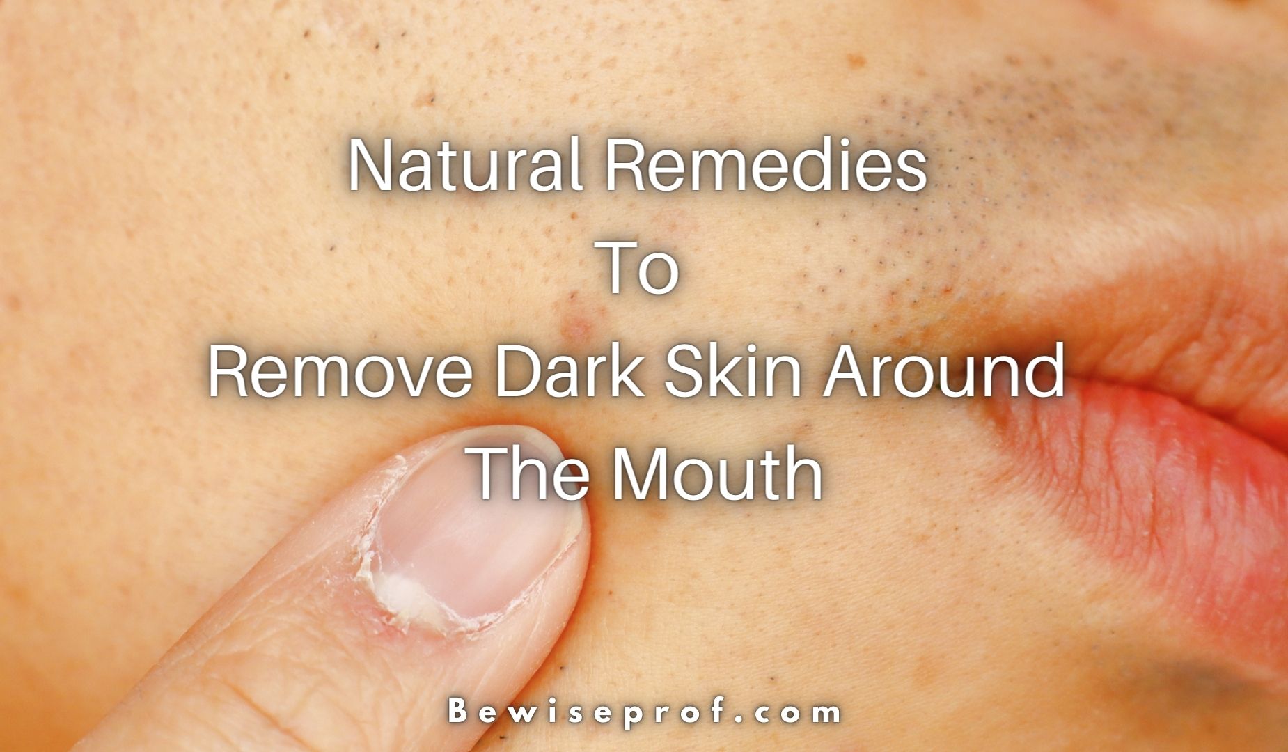 Natural Remedies To Remove Dark Skin Around The Mouth