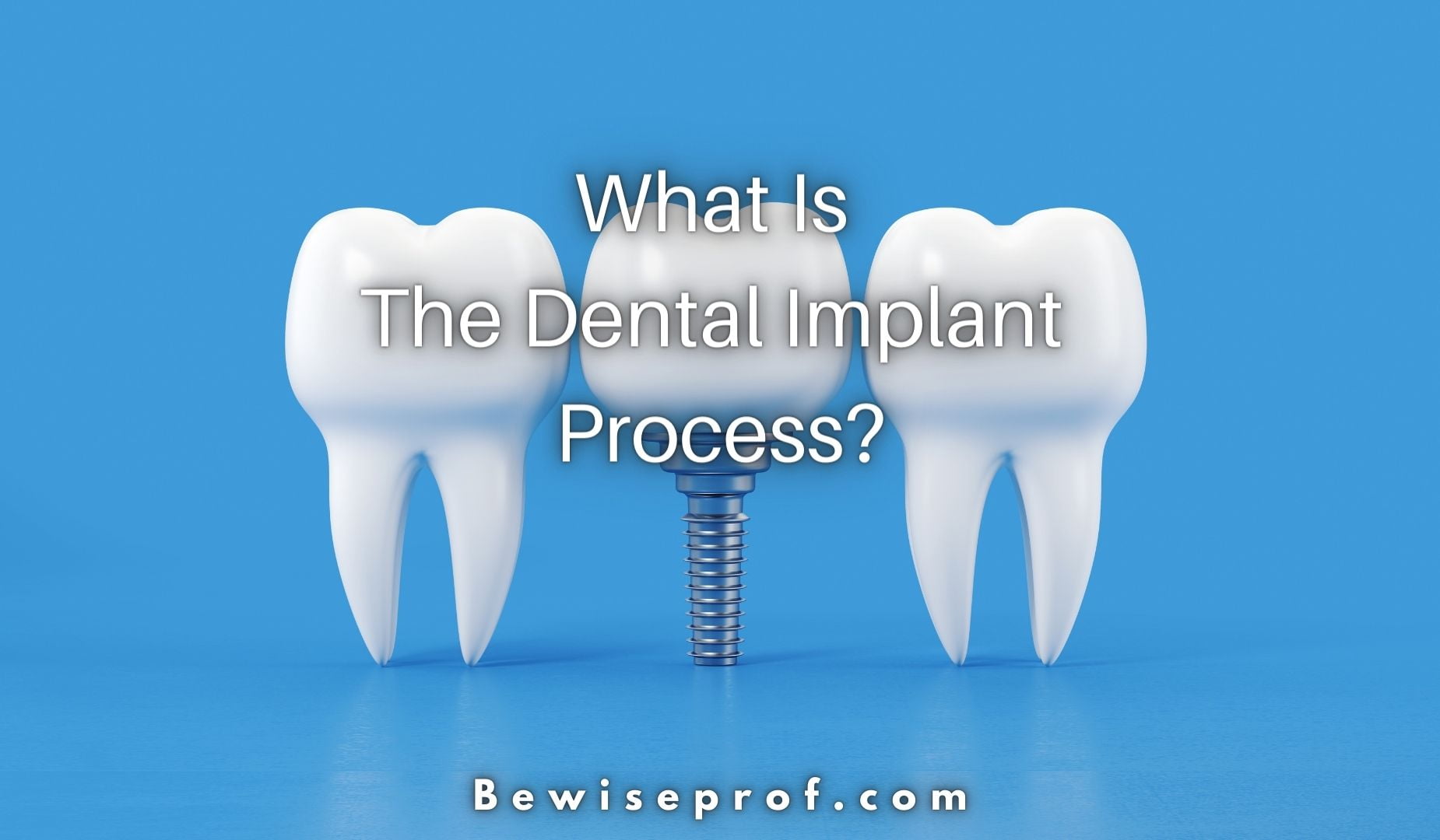 What Is The Dental Implant Process?