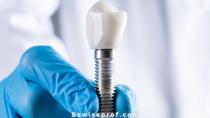 The True Cost Of Dental Implants